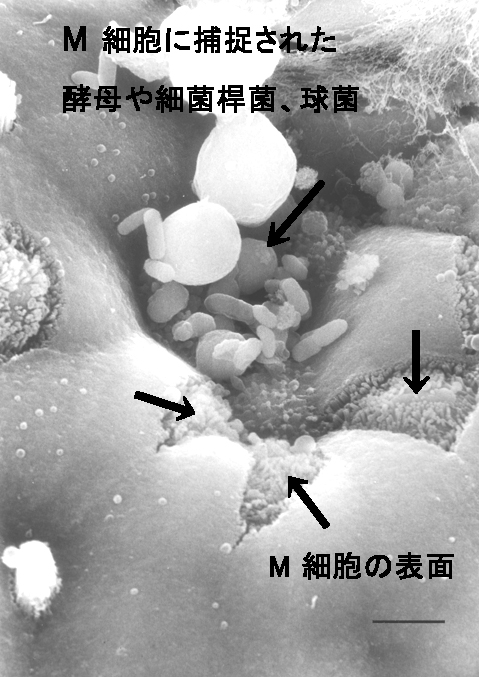 M細胞　電子顕微鏡図-2.jpg